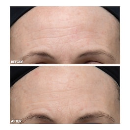 Alpha Beta® - Ultramildes Peeling für den Alltag